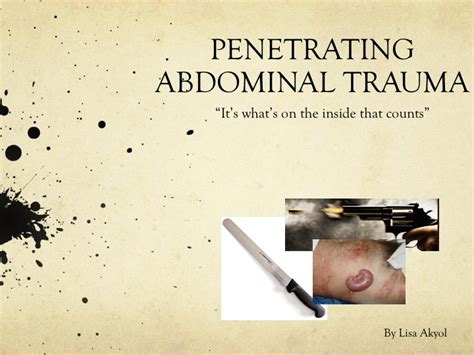 Penetrating Abdominal Trauma — learnED