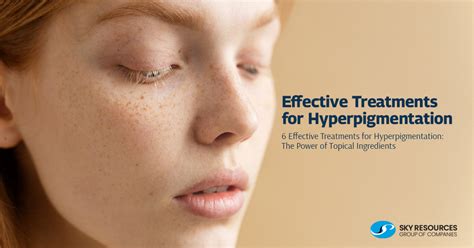 Hyperpigmentation: Types, Causes & Treatments