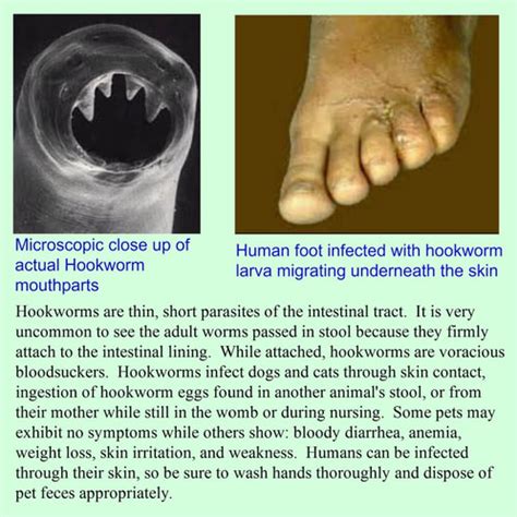 hookworms in cats affect humans - Fatima Kasper