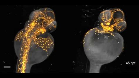 Beautiful imaging of zebrafish development - YouTube