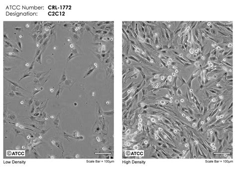 C2C12细胞ATCC CRL-1772细胞 小鼠成肌细胞株购买价格、培养基、培养条件、细胞图片、特征等基本信息_生物风