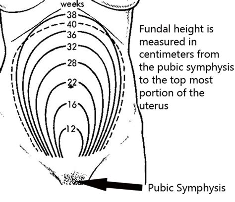 VirtualMedStudent.com || Fetal Surveillance