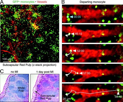 Monocytes: Protagonists of Infarct Inflammation and Repair After Myocardial Infarction | Circulation