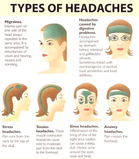 #headaches #types #more #of Types of Headaches … | Headache types, Migraines remedies, Migraine