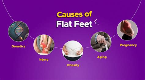 Flat feet: Causes and Symptoms - MyFrido