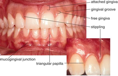 1: A Whistle-Stop Tour of the Periodontium | Pocket Dentistry