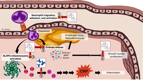 Colchicine in Cardiovascular Disease: In-Depth Review | Circulation