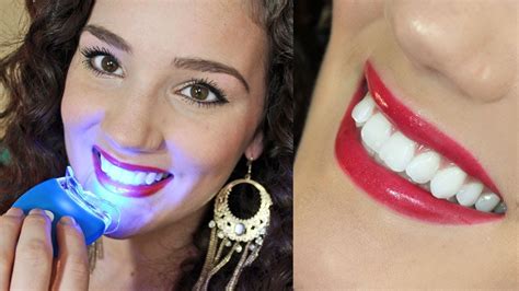 Affordable Effective Teeth Whitening - Smile Bright Review - YouTube