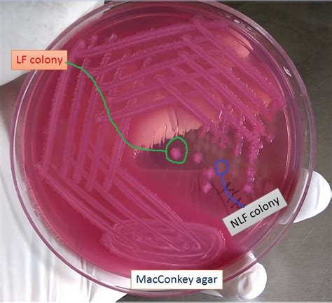 Macconkey Agar Lactose Fermentation