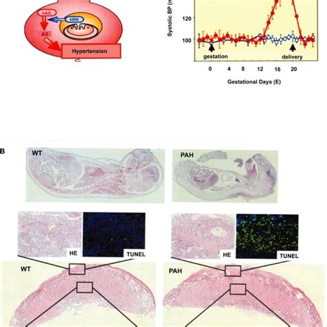 Histology of the placenta in human (A) and mouse (B). The photo of... | Download Scientific Diagram