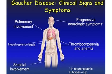 Type 3 Gaucher Disease