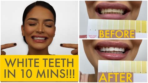 HiSmile Teeth Whitening Kit - Review Tube