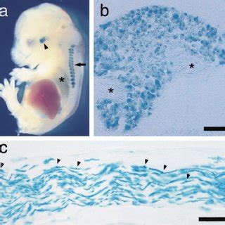 The distribution pattern of lacZ expression in the peripheral organs.... | Download Scientific ...