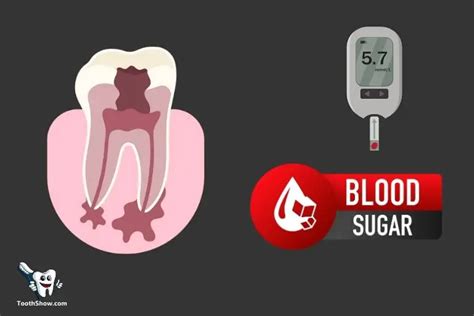 Can A Tooth Abscess Cause High Blood Sugar? Yes!