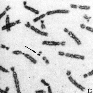 -Some example of G-banding identification of chromosomes previously... | Download Scientific Diagram