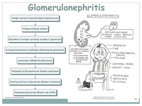 Glomerulonephritis - Nurses Revision