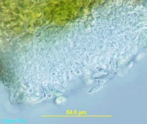 Ash - Anthracnose Discula - Cooperative Extension: Insect Pests, Ticks and Plant Diseases ...