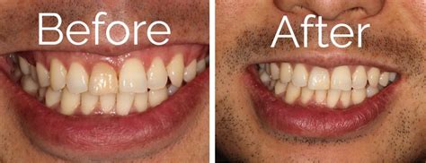 Before and After Dental | Knoxville, TN Dentist