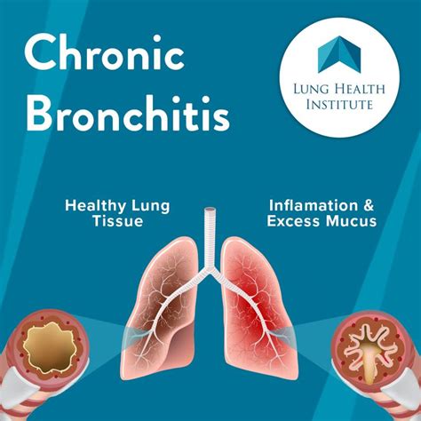 Cellular therapy outcomes | Lungs health, Chronic obstructive pulmonary disease, Bronchitis symptoms