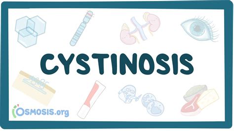 Cystinosis - causes, symptoms, diagnosis, treatment, pathology - YouTube