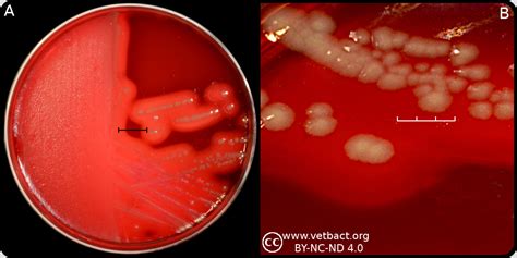 Fusobacterium necrophorum subsp. necrophorum