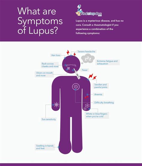 What are the symptoms of Lupus? [INFOGRAPHIC]