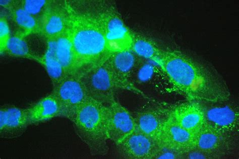 beta-2 Microglobulin Antibody (PA5-95426)