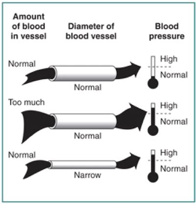 How High Blood Pressure Affects Your Kidneys, Kidney Month