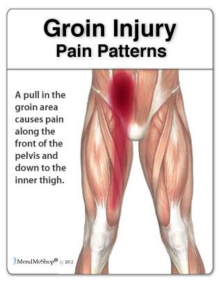 Inguinal Ligament Pain