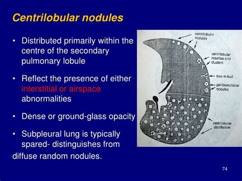 Technical aspect of hrct; normal lung anatomy & hrct findings of lung…