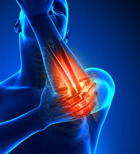 What is Tennis Elbow? Causes, Symptoms & Treatment | Panther Sports Medicine