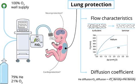 Frontiers | Neonatal Applications of Heliox: A Practical Review