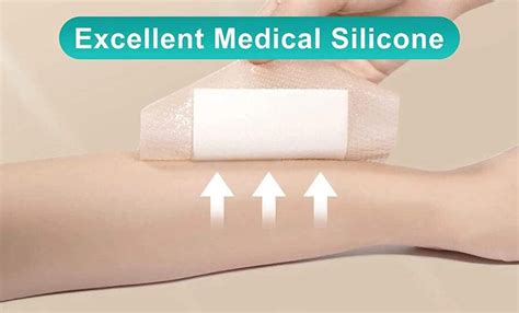 The Action Mechanism and Application of Closed Wound Dressing | by dimora | Medium