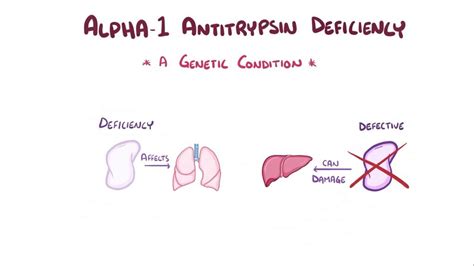 Alpha 1-antitrypsin deficiency: Video & Anatomy | Osmosis