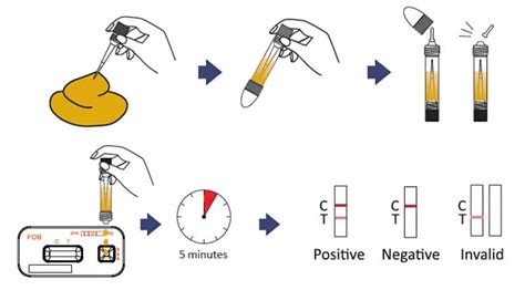 Fecal Occult Blood Test well explained (updated version) - Laboratory Insider