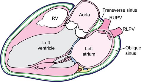 The transverse and oblique sinuses of the pericardium: Anatomic and echocardiographic insights ...