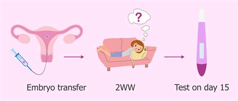 Symptoms After Embryo Transfer - Most Common Positive Signs