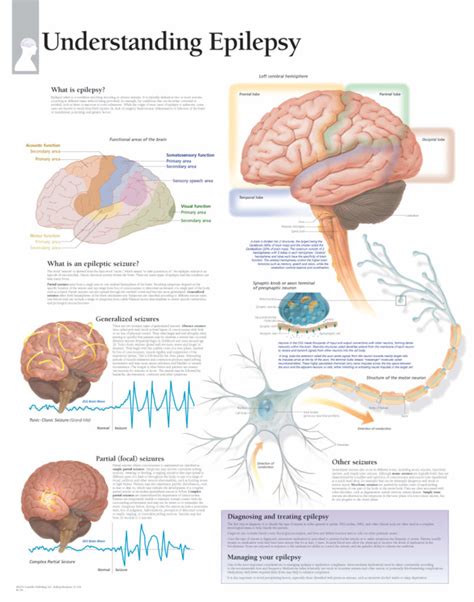 Understanding Epilepsy | Scientific Publishing