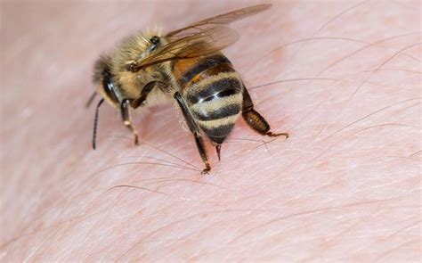 Blog - Home Remedy For Bee Stings