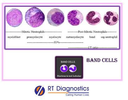 Band Count | RT Diagnostics