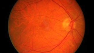 The space technology coming to save your sight | TechRadar