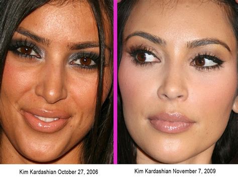 Before And After- Kim Kardashian (surgery Or Not) Pictures, Photos, and Images for Facebook ...