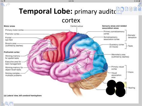 Anatomy Of Medial Temporal Lobe Download Scientific D - vrogue.co