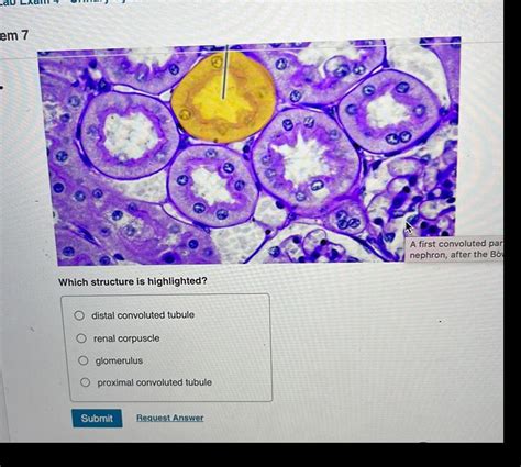 [ANSWERED] em 7 Which structure is highlighted distal convoluted tubule - Kunduz