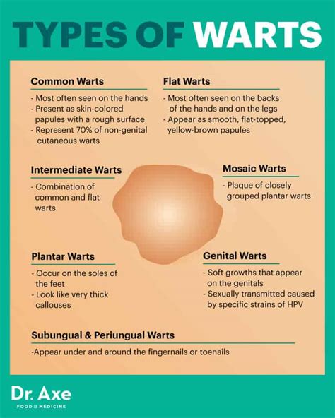 Common Warts Treatment