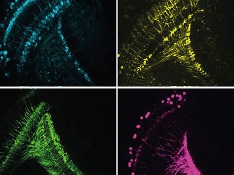 The More Active the Fly, the Faster Its Brain Works - Neuroscience News