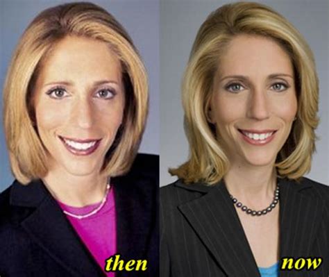 Dana Bash Plastic Surgery Before And After Photos