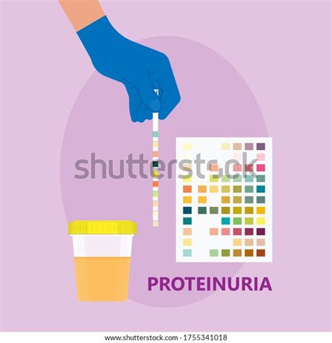 Protein Urine Proteinuria Sign Symptoms Kidney Arkivvektor (royaltyfri) 1755341018 | Shutterstock