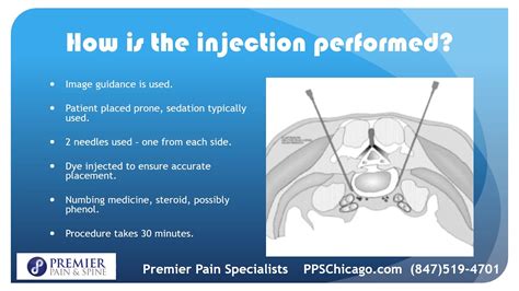 Superior Hypogastric Plexus Block info from a Chicago Pain Center (847) 519-4701 - YouTube