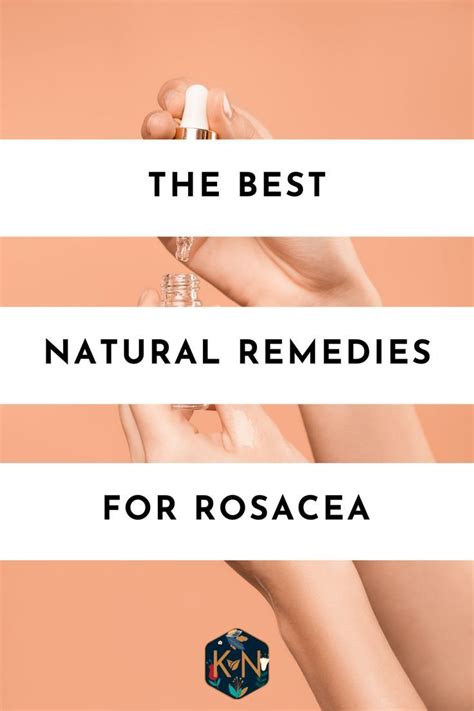 Pin on Natural Remedies for Rosacea